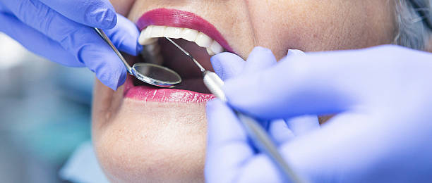 Best Emergency Treatment for Dental Infections or Abscesses in Carrington, ND